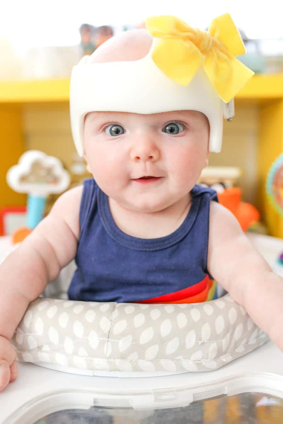 plagiocephaly helmet cost